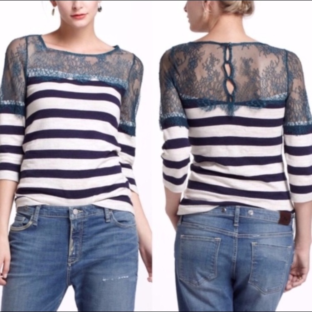 Mixed Media Striped Lace Top